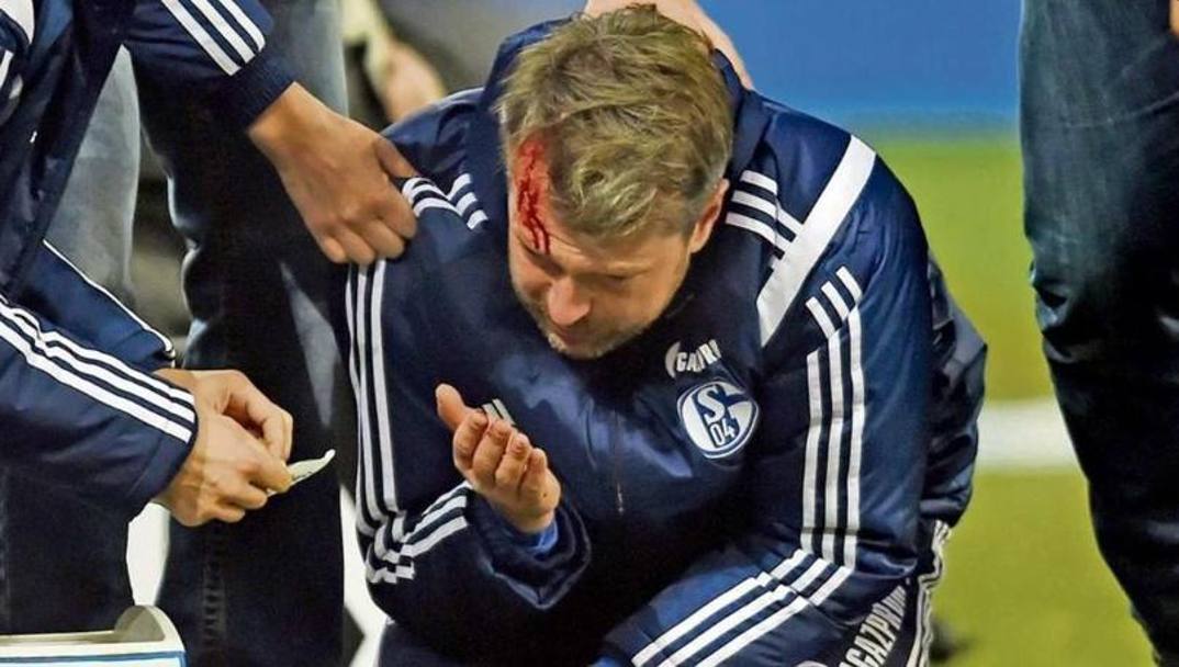 Sven Hubscher, assistente di Di Matteo,  stato colpito da un accendino lanciato dalle tribune durante Schalke 04-Colonia di Bundesliga. (Twitter)
